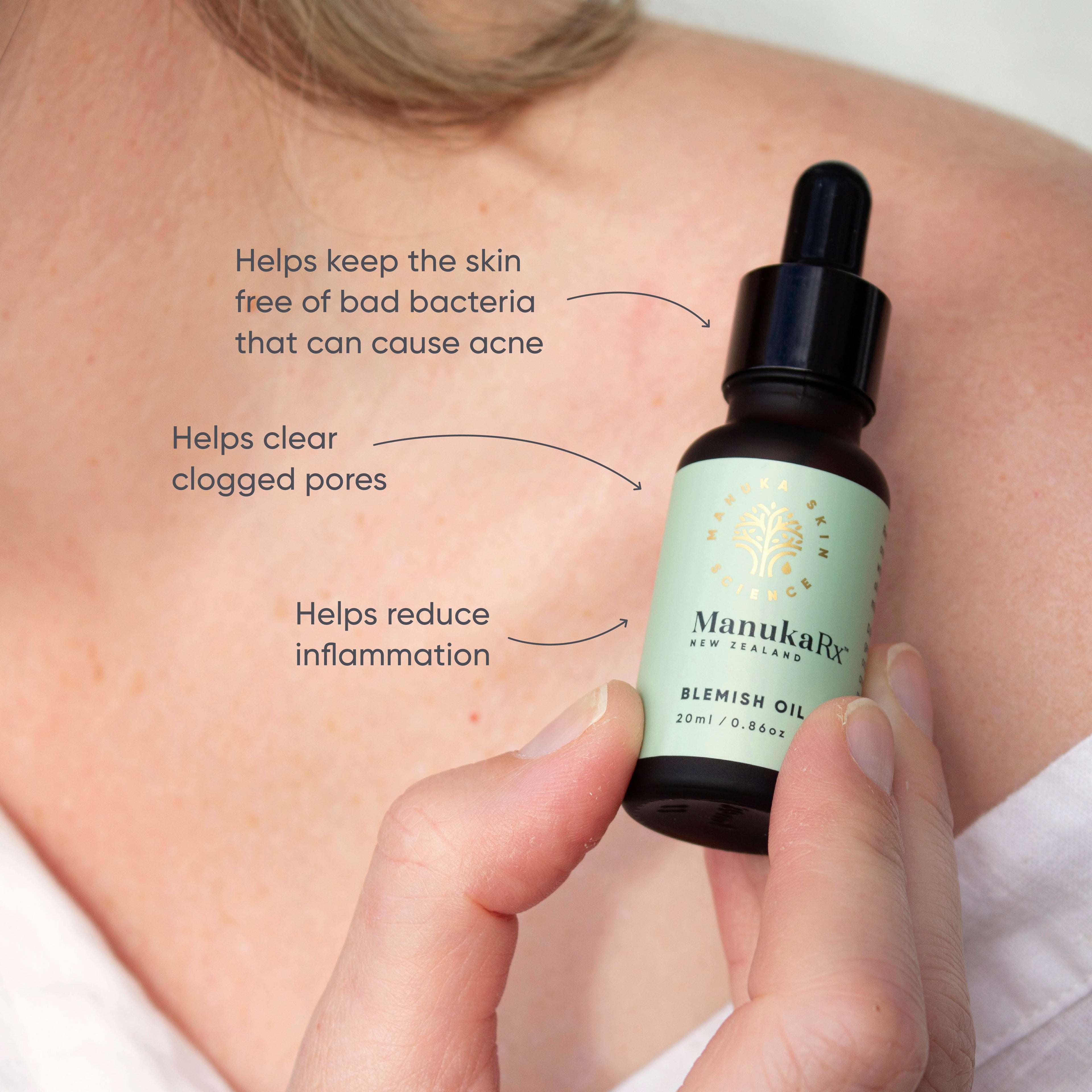 Blemish Oil