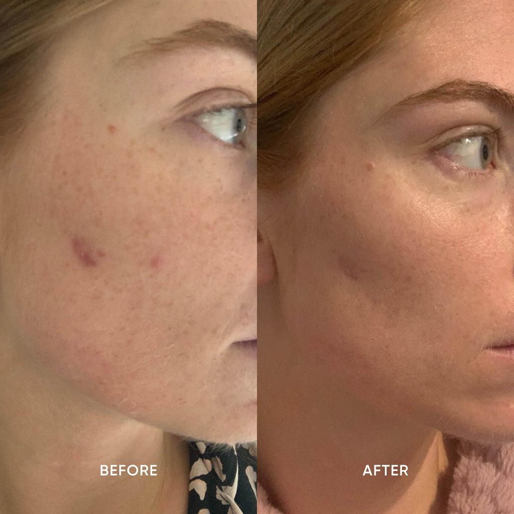 Rejuvenating Mānuka Oil Exfoliant