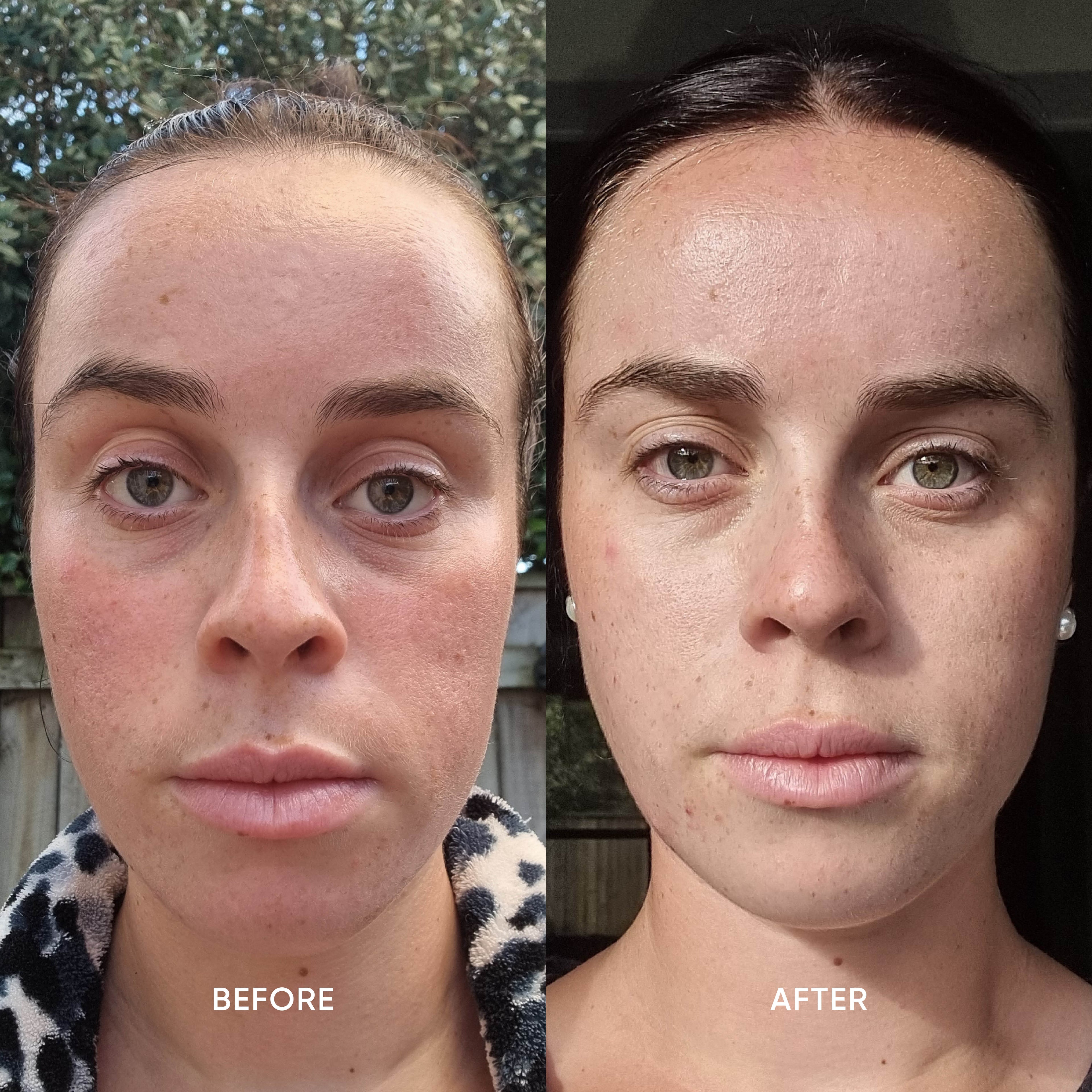 Vitamin C Gel Cleanser
